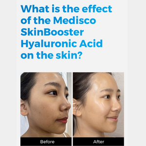 Medisco SkinBooster Hyaluronic Acid Ampoule (10vials x 5ml)