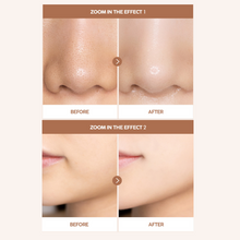 Load image into Gallery viewer, 55% OFF - MEDISCO TokTok Pack - Co2 Carboxy Therapy - 2pk