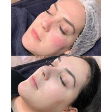 Load image into Gallery viewer, 30% OFF Stayve Customized Dermawhite No 1 & 2 - BB Glow Starter Kit (12pcs x 8ml)