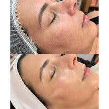Load image into Gallery viewer, 30% OFF Stayve Customized Dermawhite No 1 & 2 - BB Glow Starter Kit (12pcs x 8ml)