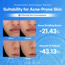 Load image into Gallery viewer, Lesimo Hyaluronic Acid Aqua Serum 1X50ml